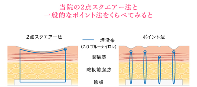 2点スクエアー法とポイント法の比較